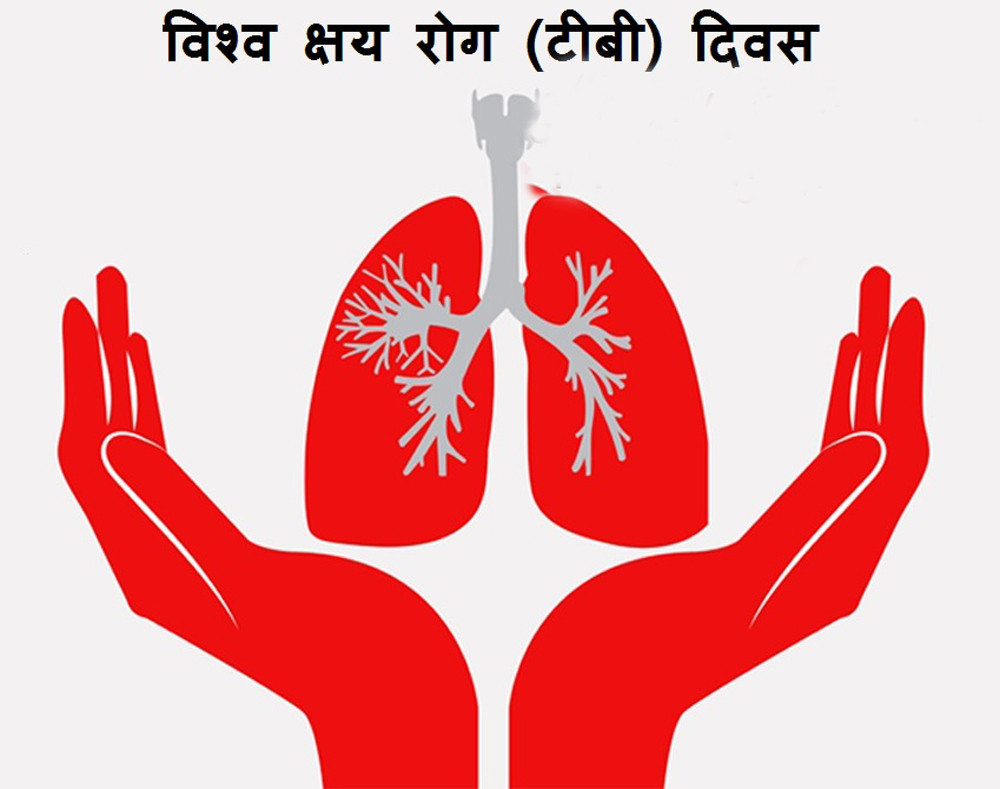 क्षयराेग दिवस : रोगभन्दा रोगीलाई हेर्ने दृष्टिकोण जटिल बन्दै