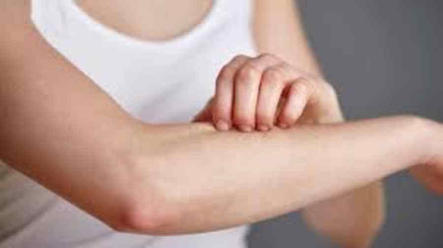 गर्मीमा छालाकाे स्याहार कसरी गर्ने ?