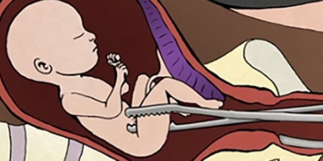 असुरक्षित गर्भपतन ज्यानै जोखिममा