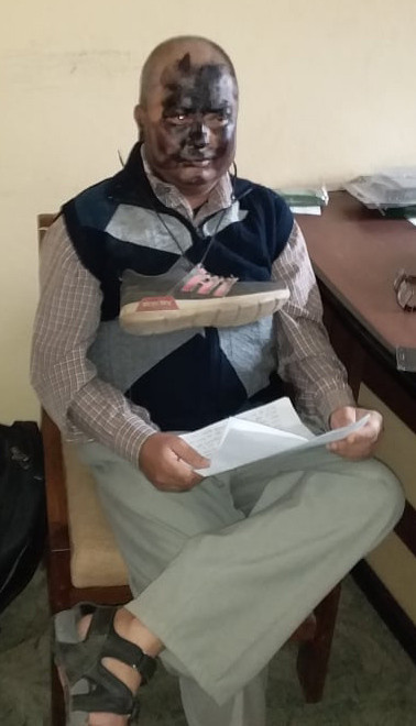कृषि क्याम्पसका प्राध्यापकलाई कालो मोसो