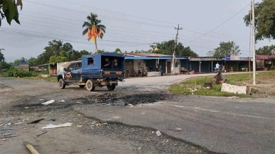 देवानगञ्जमा गोली लागेर घाइते यादवको शल्यक्रिया, गोली निकालियो